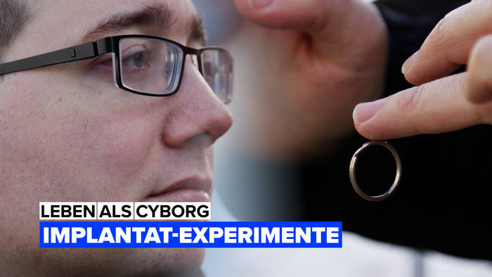 Video: Leben als Cyborg: Beobachte, wie ein Implantat durchgeführt wird
