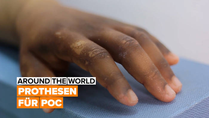 News video: Prothesen für Persons of Colour