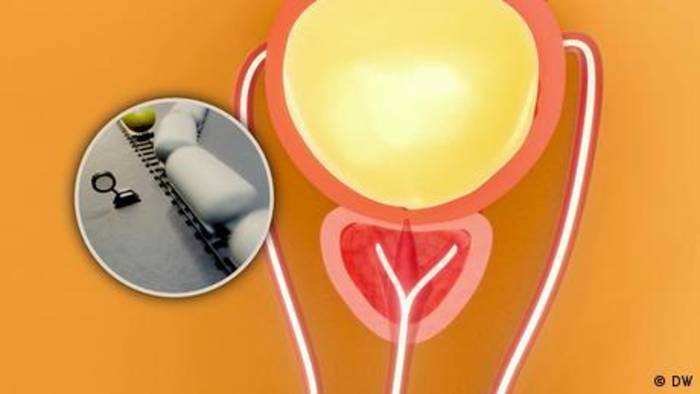 News video: Prostata: Wie sie den Verkehr im Männerkörper regelt